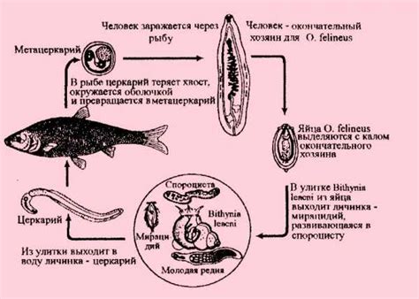 Описторхоз: симптомы и проявления заболевания