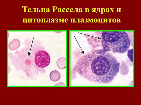 Определение, роль и функция плазмоцитов