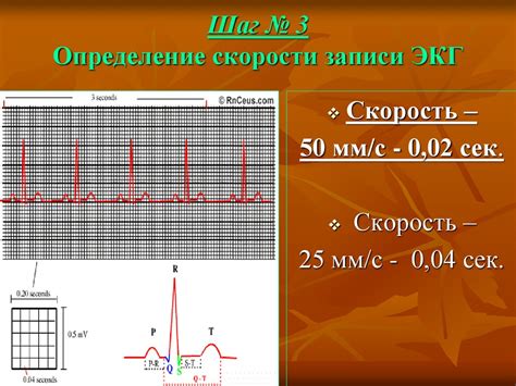 Определение ЭКГ-диагностики