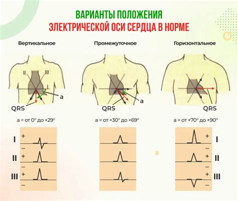 Определение и расположение