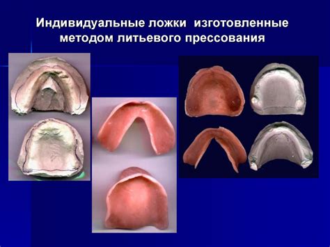 Определение мощи челюсти для питания