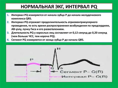 Определение нормальной ЭКГ