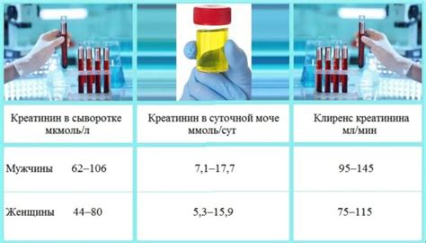 Определение показателей уровня креатинина