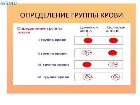 Определение резус-фактора