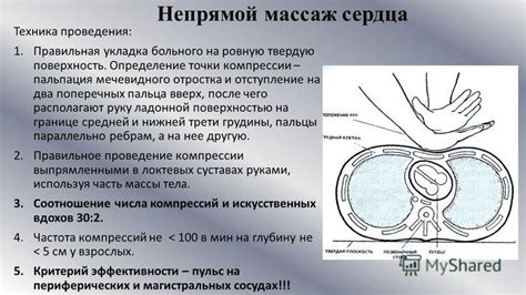 Определение точки компрессии на лапе