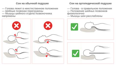 Оптимальная поза во время ФГС