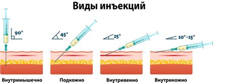 Оптимальное место для инъекции: