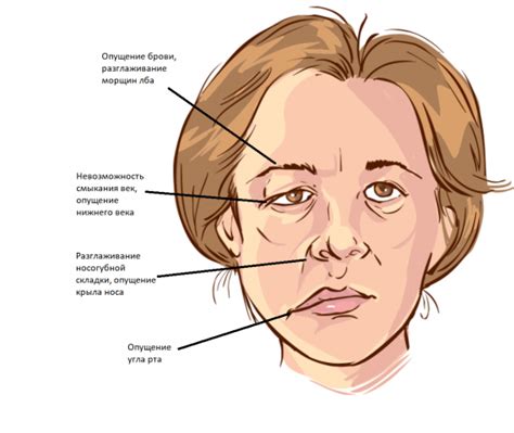Опухшая одна сторона лица: симптомы и причины