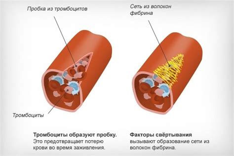 Осложнения от мутации крови у мужчин