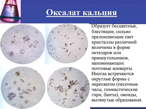 Осложнения от повышенного кальция в моче