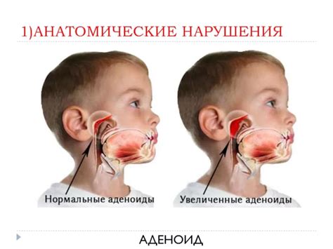 Основные признаки нарушений аденоидов в детском организме