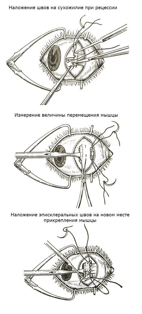 Основные принципы глаза