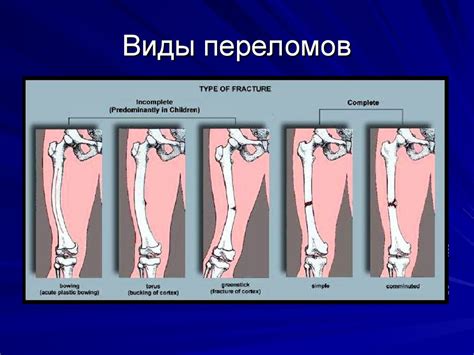 Основные принципы лечения вывиха колена