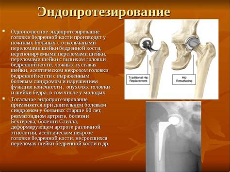 Основные причины возникновения дисплазии у мужчин