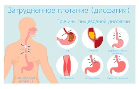 Основные причины возникновения дисфагии у взрослых