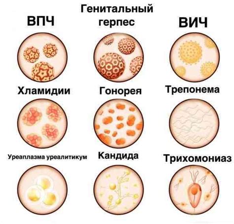 Основные проблемы с волосами на половых органах