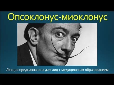 Основные симптомы опсоклонус миоклонус синдрома у детей