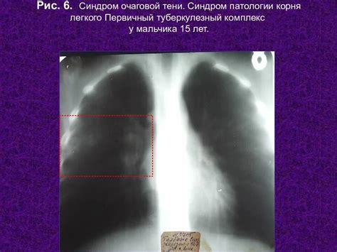 Основные симптомы очаговой патологии