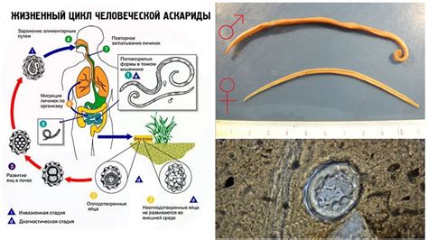 Особенности движения аскариды в кишечнике