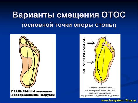 Особенности стопы