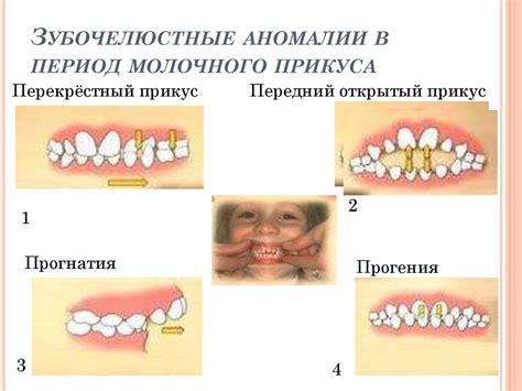 Особенности строения челюсти