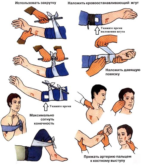 Остановите кровотечение сразу и правильно