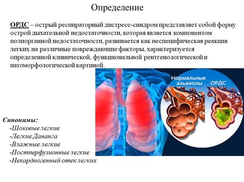 Острый респираторный синдром