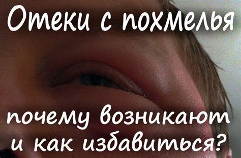 Отек лицевых жил