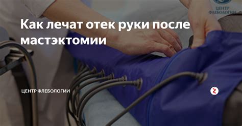 Отек руки после введения воды