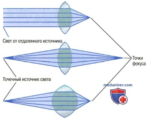 Отрицательная диоптрия и фокусировка глаза