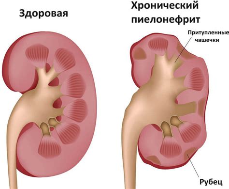 Отсутствие роста микрофлоры в моче: причины и последствия