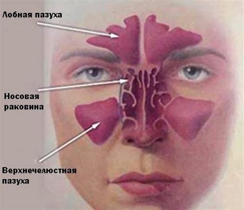 Очищение носовых проходов для предотвращения заболеваний