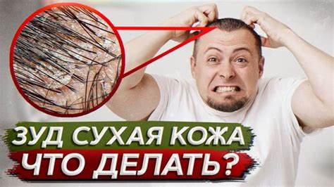 Ощущение раздражения и зуда на коже головы