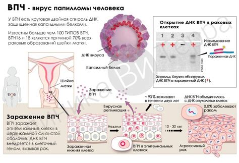 Папилломавирус 58 типа у женщин