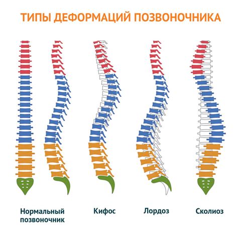 Параграфы про позвоночник