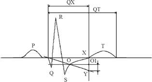 Параметры, измеряемые при проведении ЭКГ
