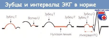 Параметры комплекса QRS в норме