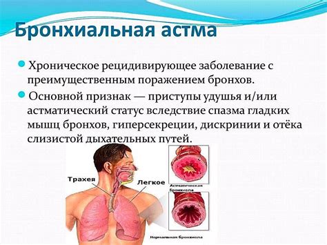 Патологическая одышка: виды и основные симптомы