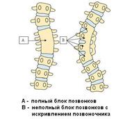 Патологическое сращение