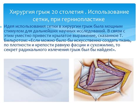 Паховая грыжа у женщин: полезные отзывы и советы