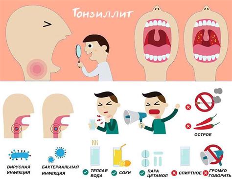 Первоначальная диагностика и симптомы гнойного тонзиллита