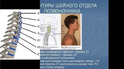 Передозировка нагрузкой на шейный отдел - симптомы и меры предосторожности