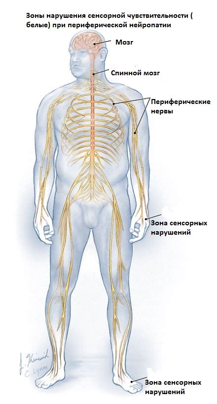 Периферическая невропатия