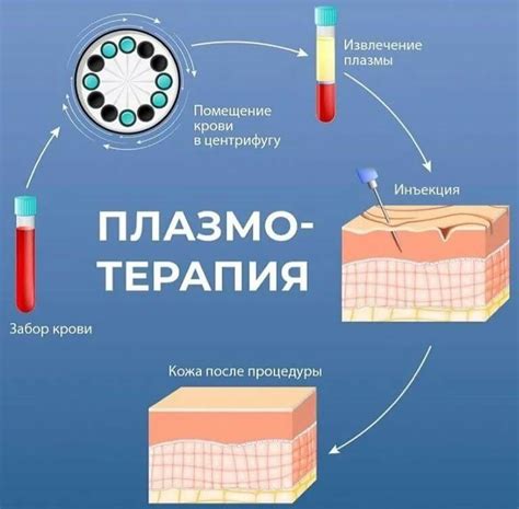 Плазмолифтинг: основные принципы и результаты