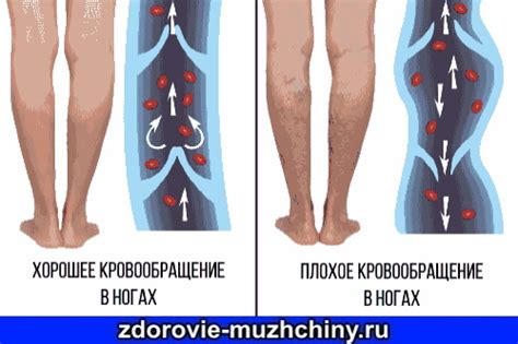 Плохая кровообращение: причины и симптомы