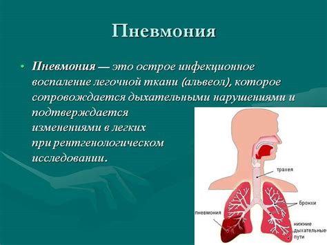 Пневмония и ее распространение