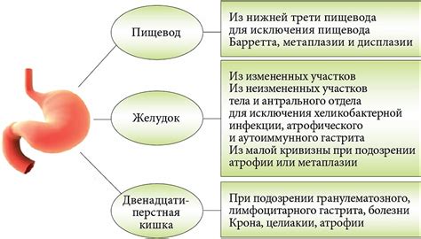 Повреждение желудочно-кишечного тракта