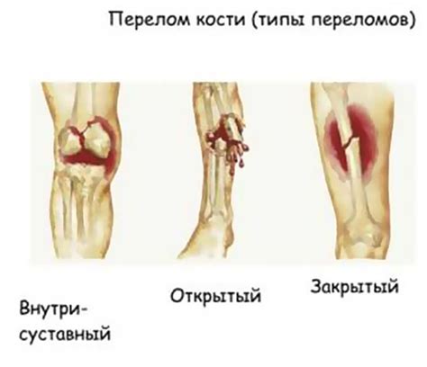 Повреждения и травмы