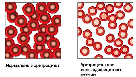 Повышение уровня гемоглобина у женщин