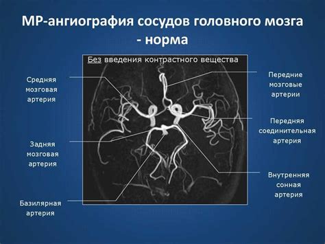 Подготовка к ангиографии БЦА